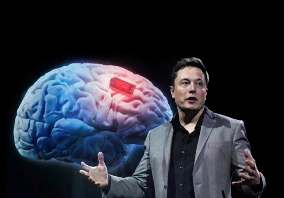 Илон Маск намеревается внедрить компьютер в твой мозг