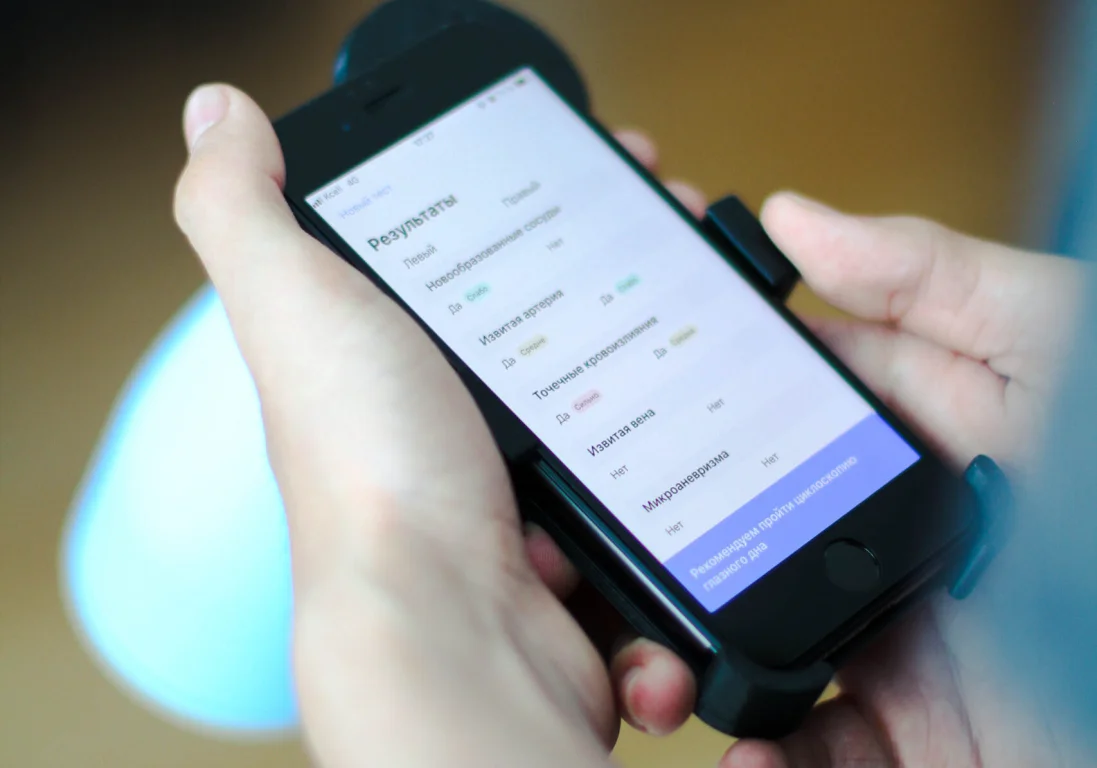 Как диагностировать сахарный диабет с помощью мобильного приложения - The  Steppe