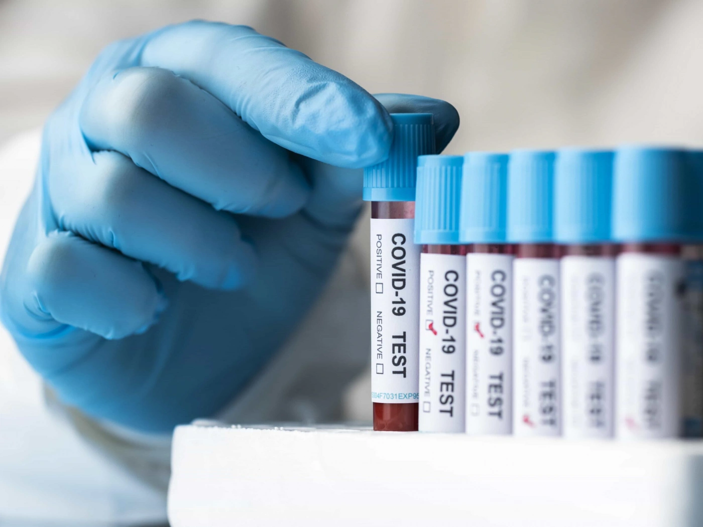 Как минимум в 29 странах мира выявлен новый подвид COVID-19
