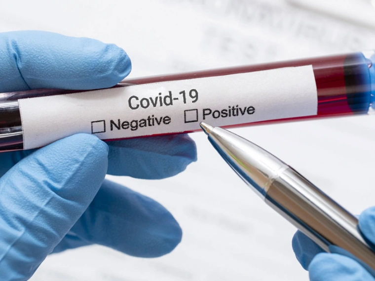 Тесты на COVID-19 в Казахстане: Как и кому нужно проходить?