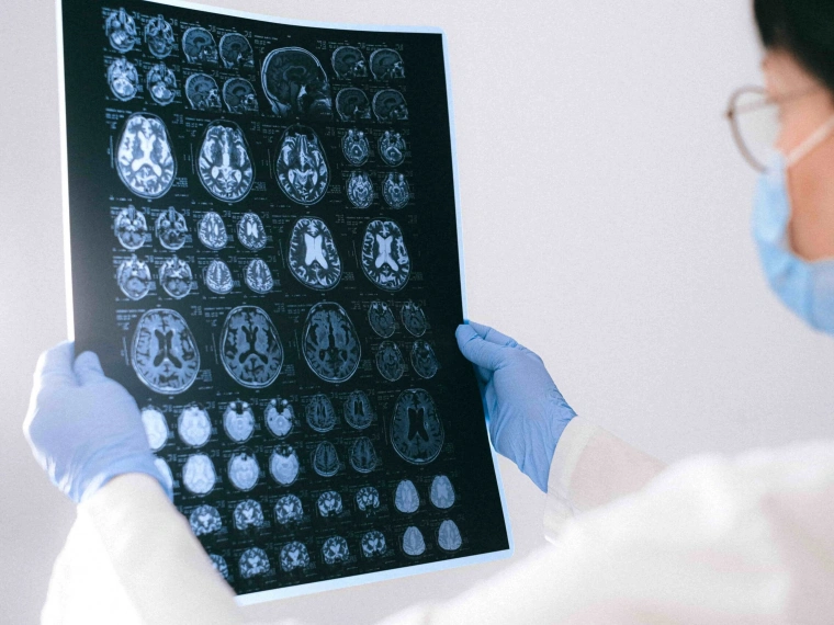 Казахстанский проект Cerebra вошел в топ-5 мировых стартапов по диагностике заболеваний мозга