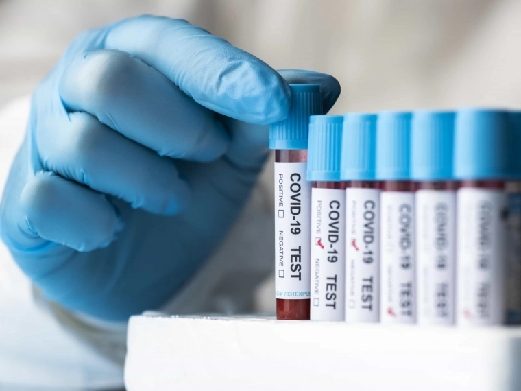 Как минимум в 29 странах мира выявлен новый подвид COVID-19