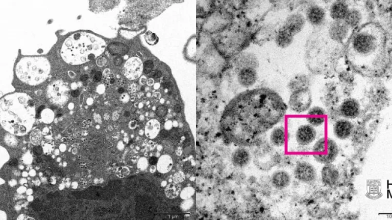 Опубликовано первое изображение омикрон-штамма коронавируса