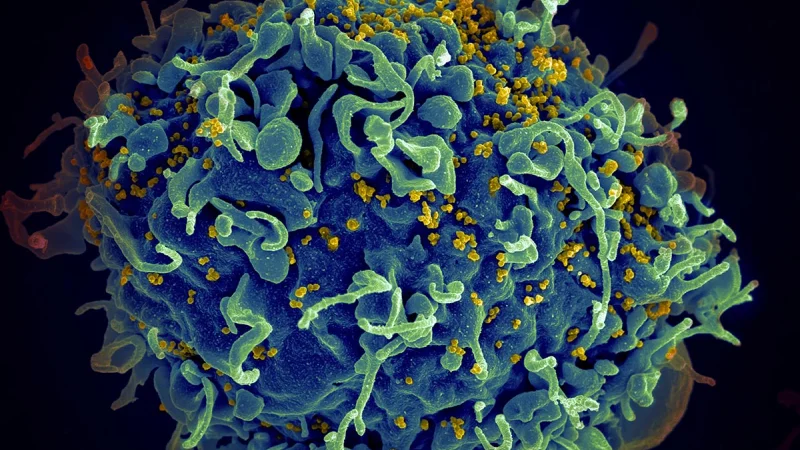 В Нидерландах обнаружен новый вариант ВИЧ
