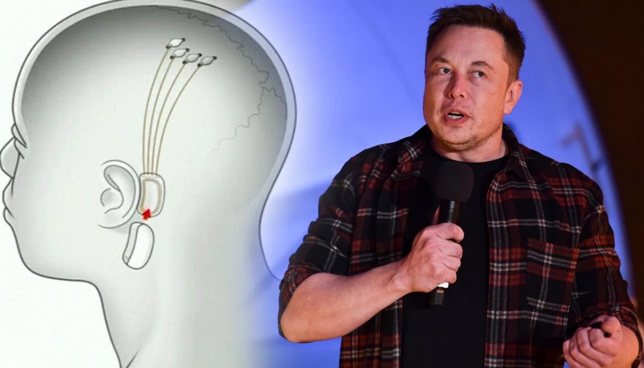 Musk and his brain machine